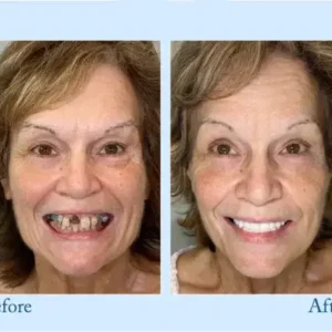 ๐๐ข๐๐จ๐ง๐ยฎ ๐๐ซ๐๐ฆ๐ข๐ฎ๐ฆ ๐๐๐ง๐ญ๐ฎ๐ซ๐