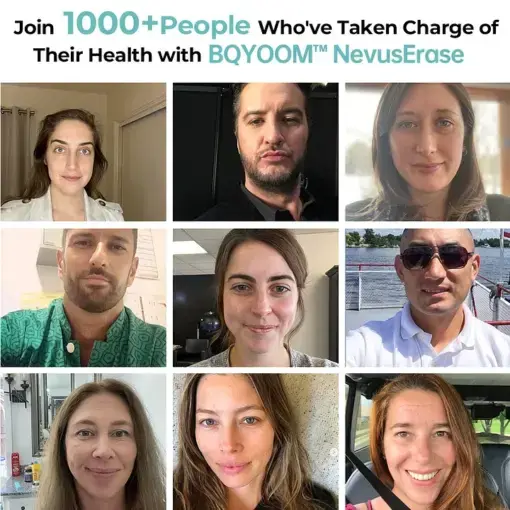 BQYOOM™ Nevus Erase Instant Mole & Spot Removal Gel