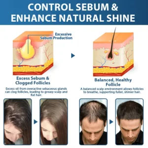 🇺🇸🌱Developed by Trichologists: 𝐑𝐨𝐥𝐢𝐦𝐞𝐲® 𝐒𝐓𝐄𝐌 𝐂𝐞𝐥𝐥 𝐇𝐚𝐢𝐫 𝐂𝐲𝐜𝐥𝐞 𝐑𝐨𝐥𝐥𝐞𝐫 – Instantly Stops Hair Loss & Promotes Real Regrowth (🔥UP TO 80% OFF🔥)