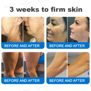 ✨✨💧(Made and Shipped from UK)✨Rolimey® Advanced Firming & Wrinkle-Reducing Cream (with SPF 50+)✨LAST DAY 60% OFF