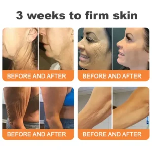 💎Made and Shipped from UK✨Rolimey® Instant FirmLift Temporary EYE Tightener🔥LAST DAY 70% OFF