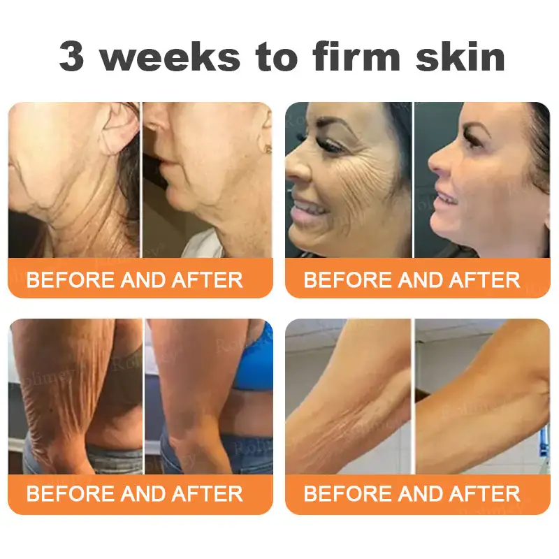 💎Made and Shipped from UK✨Rolimey® Instant FirmLift Temporary EYE Tightener🔥LAST DAY 70% OFF