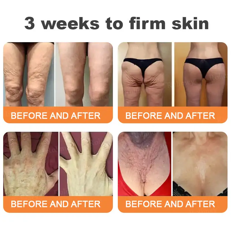 💎Made and Shipped from UK✨Rolimey® Instant FirmLift Temporary EYE Tightener🔥LAST DAY 70% OFF