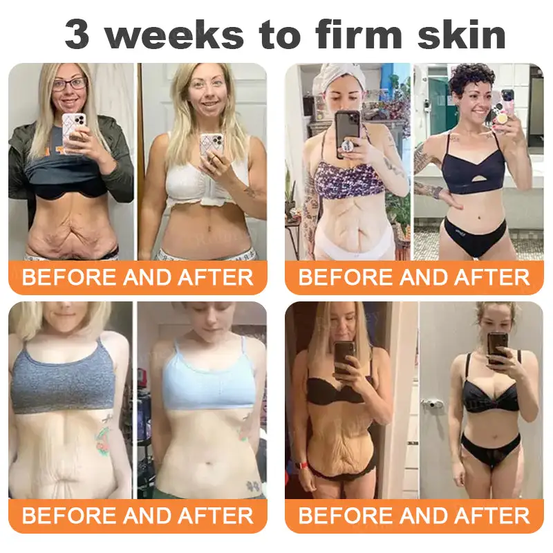 💎Made and Shipped from UK✨Rolimey® Instant FirmLift Temporary EYE Tightener🔥LAST DAY 70% OFF