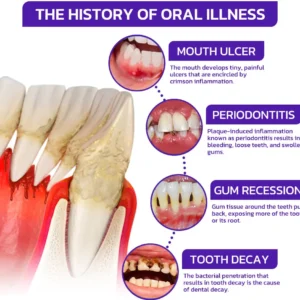 Rolimey® VioCore Bee Venom Dental Treatment Toothpaste
