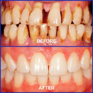 Rolimey® VioGloss Bienengift-Zahntherapie Oral Power