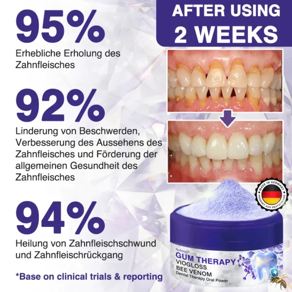 Rolimey® VioGloss Bienengift-Zahntherapie Oral Power