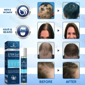✅US Owned and Operated: 𝙍𝙤𝙡𝙞𝙢𝙚𝙮® 𝙎𝙏𝙀𝙈 𝘾𝙚𝙡𝙡 𝙃𝙖𝙞𝙧 𝘾𝙮𝙘𝙡𝙚 𝙍𝙤𝙡𝙡𝙚𝙧 (Male pattern baldness · Thinning hair · Receding hairline · Postpartum hair loss · Stress-related shedding · Ageing hair · Scalp discomfort)