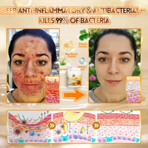 🐝🌿FDA Approved|Rolimey® Bee Venom Skin Restoration Cream(Anti-aging, Hydrating, Skin Repair, Even Tone, Acne and Dark Spot Treatment, Wart and Mole Removal, Psoriasis Relief)