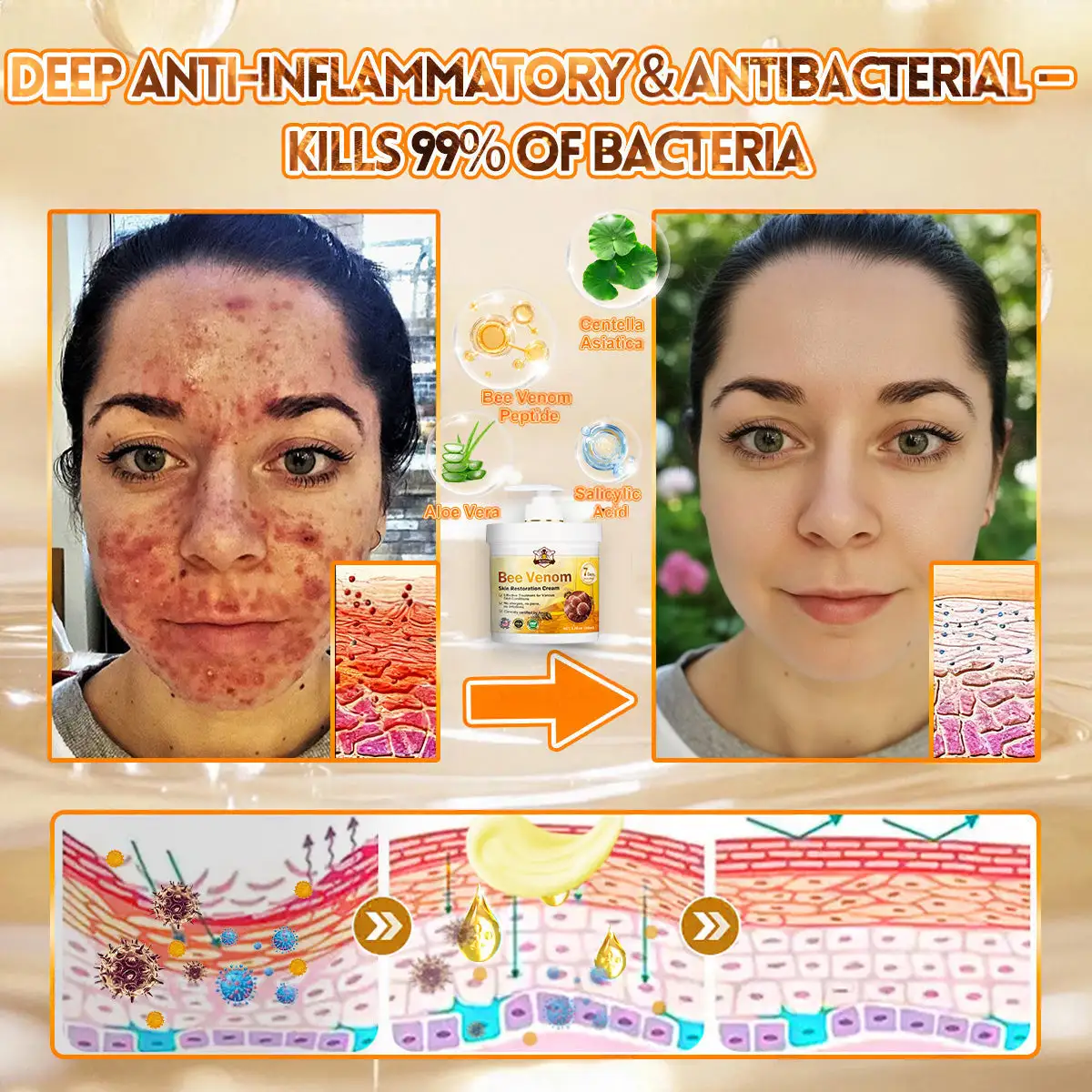 🐝🌿FDA Approved|Rolimey® Bee Venom Skin Restoration Cream(Anti-aging, Hydrating, Skin Repair, Even Tone, Acne and Dark Spot Treatment, Wart and Mole Removal, Psoriasis Relief)