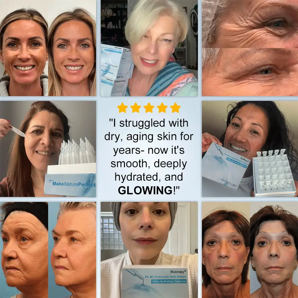 ๐Transform Your Skin in Just 3 Minutesโจ โ ๐๐จ๐ฅ๐ข๐ฆ๐๐ฒยฎ ๐% ๐๐ ๐๐ฒ๐๐ฅ๐ฎ๐ซ๐จ๐ง๐ข๐ ๐๐๐ข๐ ๐๐๐ซ๐ฎ๐ฆ ๐๐ฆ๐ฉ๐จ๐ฎ๐ฅ๐๐ฌ (Clinically proven, smooths wrinkles & hydrates instantly)