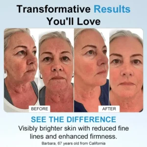 ๐Transform Your Skin in Just 3 Minutesโจ โ ๐๐จ๐ฅ๐ข๐ฆ๐๐ฒยฎ ๐% ๐๐ ๐๐ฒ๐๐ฅ๐ฎ๐ซ๐จ๐ง๐ข๐ ๐๐๐ข๐ ๐๐๐ซ๐ฎ๐ฆ ๐๐ฆ๐ฉ๐จ๐ฎ๐ฅ๐๐ฌ (Clinically proven, smooths wrinkles & hydrates instantly)