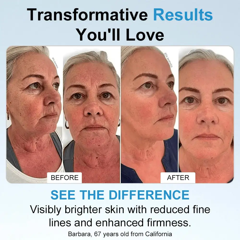 ๐Transform Your Skin in Just 3 Minutesโจ โ ๐๐จ๐ฅ๐ข๐ฆ๐๐ฒยฎ ๐% ๐๐ ๐๐ฒ๐๐ฅ๐ฎ๐ซ๐จ๐ง๐ข๐ ๐๐๐ข๐ ๐๐๐ซ๐ฎ๐ฆ ๐๐ฆ๐ฉ๐จ๐ฎ๐ฅ๐๐ฌ (Clinically proven, smooths wrinkles & hydrates instantly)