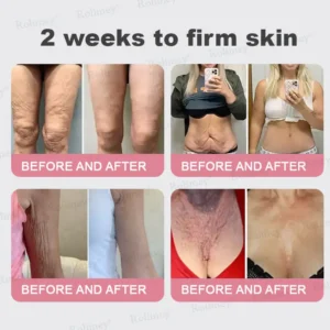 🌿Made and Shipped from UK✨ Rolimey® Bio-Botox PDRN Collagen Wrinkle Stick – Lift, Firm & Smooth Skin with Salmon DNA & Plant-Based Bakuchiol