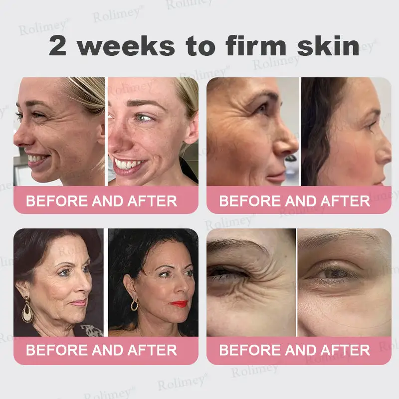 🌿Made and Shipped from UK✨ Rolimey® Bio-Botox PDRN Collagen Wrinkle Stick – Lift, Firm & Smooth Skin with Salmon DNA & Plant-Based Bakuchiol