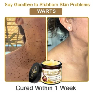 ✨Made and Shipped from UK✨Rolimey® Bee Venom Skin Comprehensive Cream Anti-aging, Hydrating, Skin Repair, Even Tone, Acne and Dark Spot Treatment, Wart and Mole Removal, Psoriasis Relief