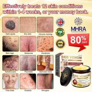 ✨Made and Shipped from UK✨Rolimey® Bee Venom Skin Comprehensive Cream Anti-aging, Hydrating, Skin Repair, Even Tone, Acne and Dark Spot Treatment, Wart and Mole Removal, Psoriasis Relief