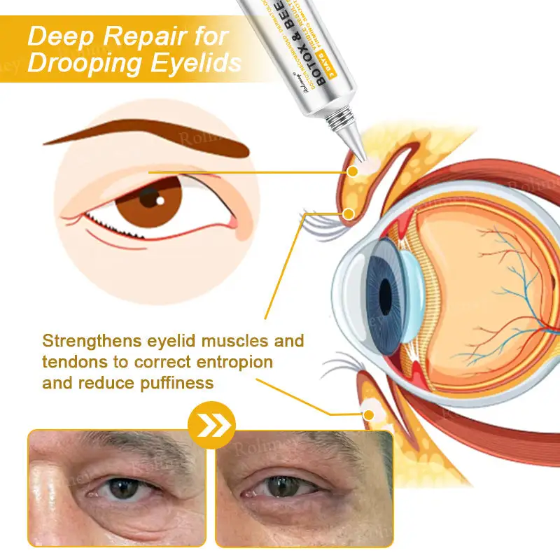 (🌟Made and Shipped from UK)✨Rolimey® Botox Bee Venom Wrinkle Removal Cream👩🔬Dermatologist-Tested🔥LAST DAY 70% OFF