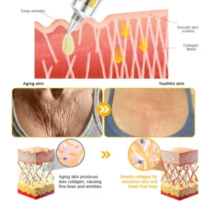 (🌟Made and Shipped from UK)✨Rolimey® Botox Bee Venom Wrinkle Removal Cream👩🔬Dermatologist-Tested🔥LAST DAY 70% OFF