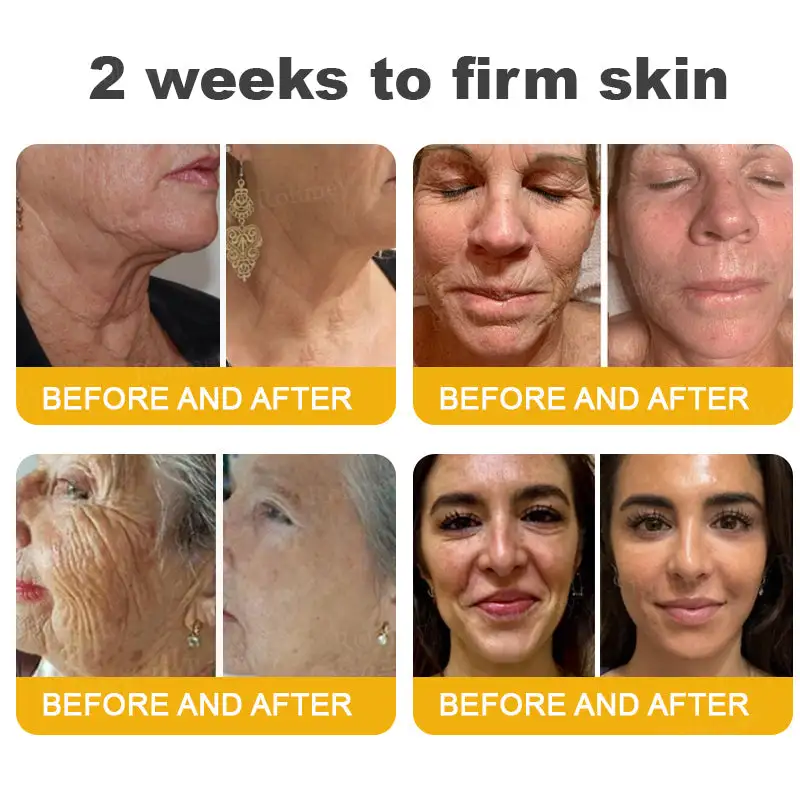 (🌟Made and Shipped from UK)✨Rolimey® Botox Bee Venom Wrinkle Removal Cream👩🔬Dermatologist-Tested🔥LAST DAY 70% OFF