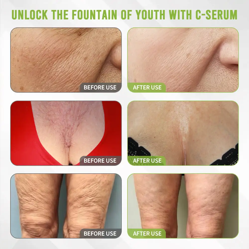 👩⚕️Rolimey® Kakadu Plum Skin Repair Serum ✅️ FDA Approved | Infused with PDRN Collagen for Eliminating Wrinkles, Stretch Marks, Age Spots