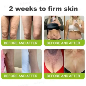 👨‍⚕️✅ Made and shipped from the USA – Rolimey® Botox & Vita-A Retinol Shot tightening and wrinkle-reducing cream – Last day of promotion, 70% OFF