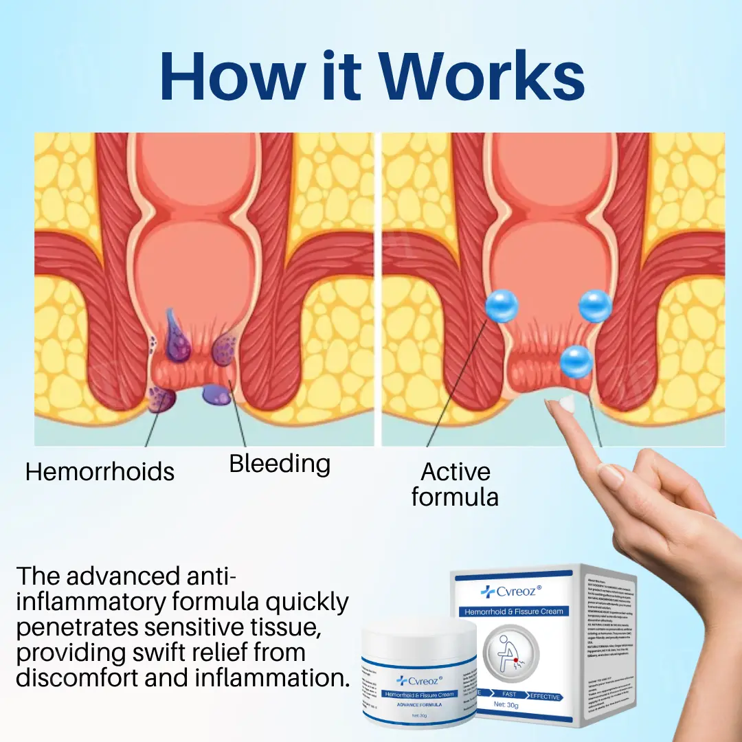 Cvreoz® Hemorrhoid & Fissure Cream