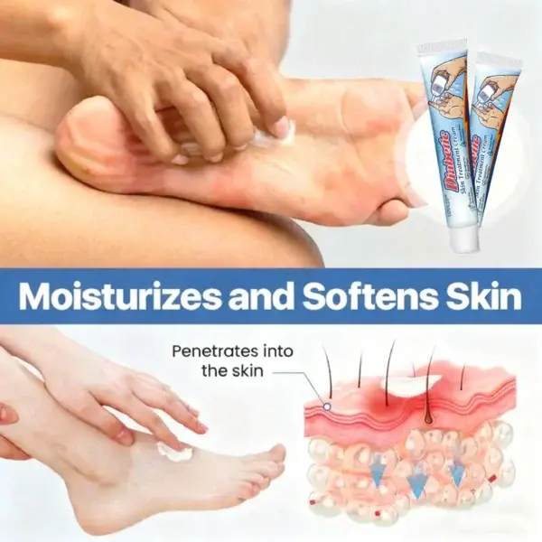 LOVILDS™ Diabetic Skin Treatment Cream