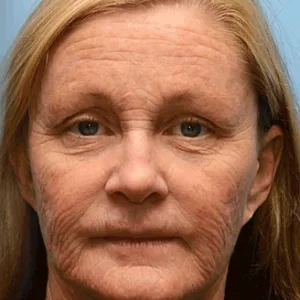 ✨👨‍⚕️Made and shipped from Canada 💫Rolimey® Botox & Vita-A Retinol Shot Wrinkle-Lift Tightening cream - Last Day Promotion 70% OFF upsell