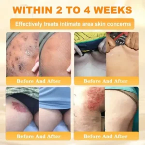 Rolimey® Bee Venom Skin Restoration Cream