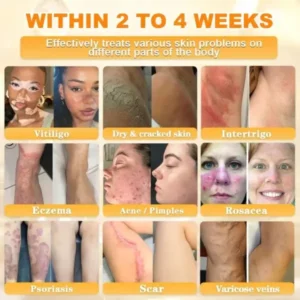 Rolimey® Bee Venom Skin Restoration Cream