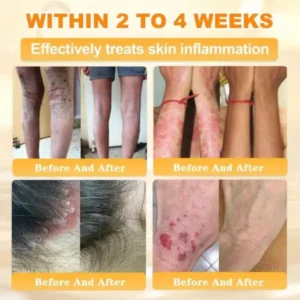 Rolimey® Bee Venom Skin Restoration Cream