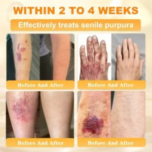 Rolimey® Bee Venom Skin Restoration Cream