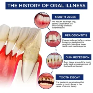 Rolimey® BeeTakt Bee Venom Dental Treatment Drops Mouthwash