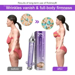 👁️💫Rolimey® NAD+ Retinol Firming & Lifting Cream – For Eye Bags, Dark Circles & Fine Lines | Last Day Sale: 60% OFF