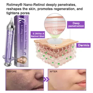 👁️💫Rolimey® NAD+ Retinol Firming & Lifting Cream – For Eye Bags, Dark Circles & Fine Lines | Last Day Sale: 60% OFF