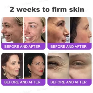 👁️💫Rolimey® NAD+ Retinol Firming & Lifting Cream – For Eye Bags, Dark Circles & Fine Lines | Last Day Sale: 60% OFF