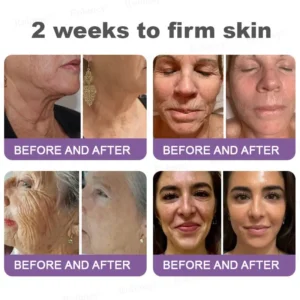 👁️💫Rolimey® NAD+ Retinol Firming & Lifting Cream – For Eye Bags, Dark Circles & Fine Lines | Last Day Sale: 60% OFF