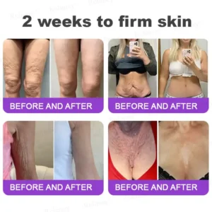 👁️💫Rolimey® NAD+ Retinol Firming & Lifting Cream – For Eye Bags, Dark Circles & Fine Lines | Last Day Sale: 60% OFF