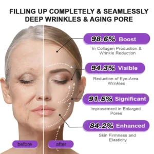 👁️💫Rolimey® NAD+ Retinol Firming & Lifting Cream – For Eye Bags, Dark Circles & Fine Lines | Last Day Sale: 60% OFF