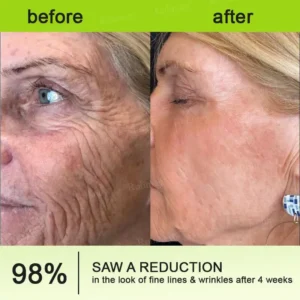 ⏰ Last Day! 70% OFF 💫 Rolimey® Botox & Vita-A Retinol Wrinkle-Lift Cream – Made & Shipped from CA 🔥