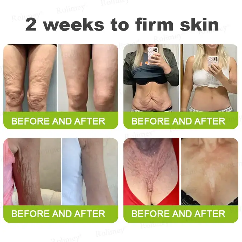 🎯 Made and shipped from the USA 🎉 Rolimey® Botox & Vita-A Retinol Shot Wrinkle-Lift Tightening Cream, Last Day Promotion 70% OFF