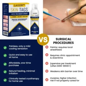 LAOZIK™ Skin Tag Cryo Treatment Spray