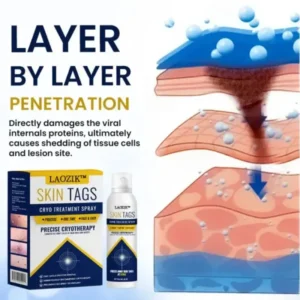 LAOZIK™ Skin Tag Cryo Treatment Spray