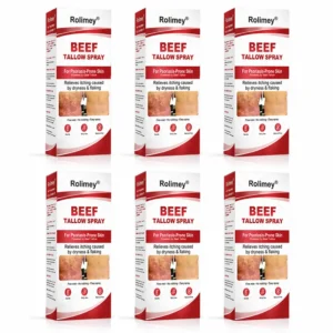 Rolimey® Beef Tallow Spray for Itchy, Flaky Psoriasis Skin