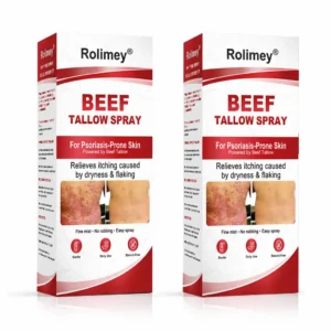 Rolimey® Beef Tallow Spray for Itchy, Flaky Psoriasis Skin
