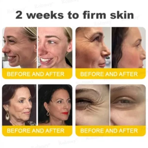 Rolimey®🗽Botox & Vita A Retinol Shot Tightening Cream🗽
