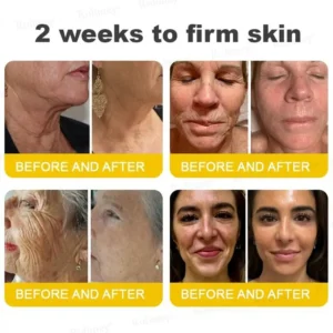 Rolimey®🗽Botox & Vita A Retinol Shot Tightening Cream🗽