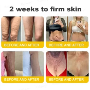 Rolimey®🗽Botox & Vita A Retinol Shot Tightening Cream🗽