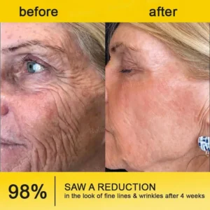 Rolimey®🗽Botox & Vita A Retinol Shot Tightening Cream🗽